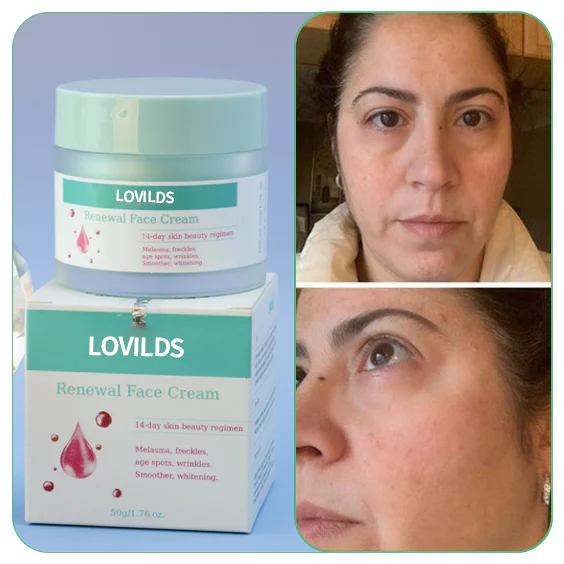 Flash Sale Ending Soonđ„LOVILDSâą Renewal Skin Cream | Spot Removal & Skin Renewal for Dark Spots, Age Spots, and Sun Spots* Daily Firming for All Skin Types