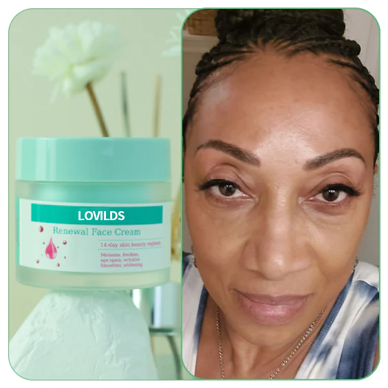 Flash Sale Ending Soonđ„LOVILDSâą Renewal Skin Cream | Spot Removal & Skin Renewal for Dark Spots, Age Spots, and Sun Spots* Daily Firming for All Skin Types