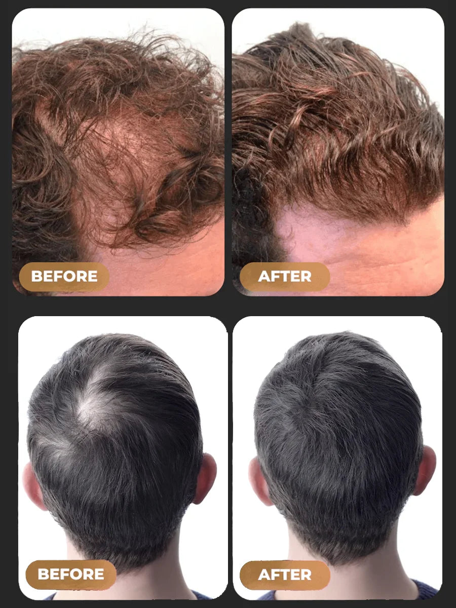 LOVILDS™Green Soap Shampoo for Thicker, Fuller Hair – Hair Growth Formula