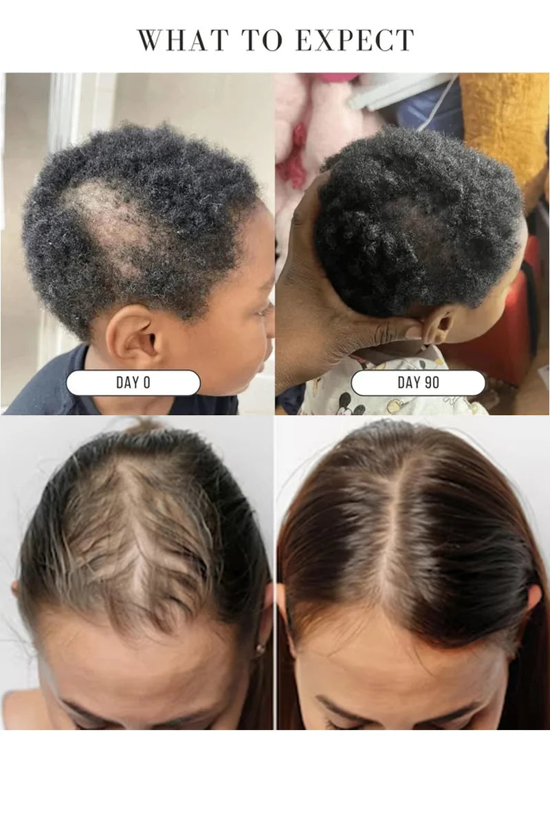 LOVILDS™Green Soap Shampoo for Thicker, Fuller Hair – Hair Growth Formula