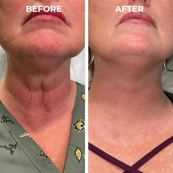 Flash Sale Ending Soonđ„LOVILDSâą Renewal Skin Cream | Spot Removal & Skin Renewal for Dark Spots, Age Spots, and Sun Spots* Daily Firming for All Skin Types