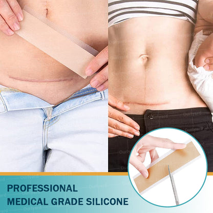 Official Store |Slimoly™ Hyaluronic Acid Nano Microneedle Repair Tape🗽🎉(Treatment of old and new scars, reduction of surgical scars, stretch marks, keloids, acne, burns, warts, dermatomes and varicose veins)