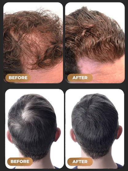 LOVILDS™Green Soap Shampoo for Thicker, Fuller Hair – Hair Growth Formula