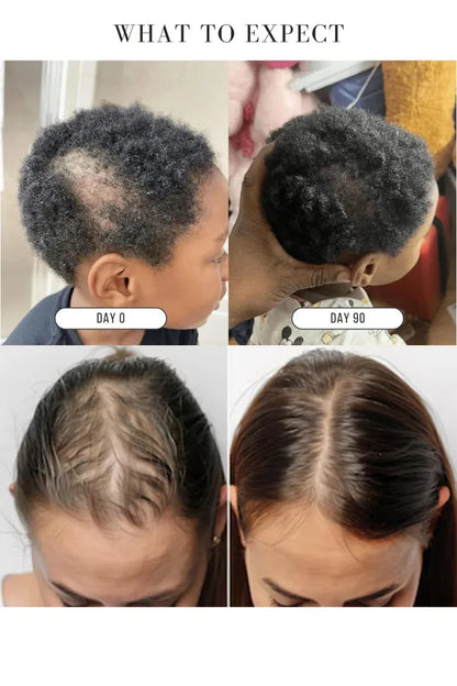 LOVILDS™Green Soap Shampoo for Thicker, Fuller Hair – Hair Growth Formula