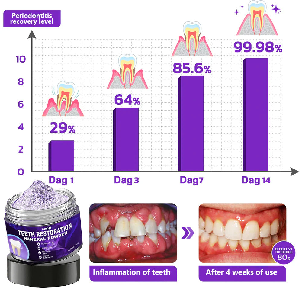 BBOJI™ Teeth Restoration Mineral Powder🦷(𝐋𝐢𝐦𝐢𝐭𝐞𝐝 𝐭𝐢𝐦𝐞 𝐝𝐢𝐬𝐜𝐨𝐮𝐧𝐭 𝐋𝐚𝐬𝐭 𝟑𝟎 𝐦𝐢𝐧𝐮𝐭𝐞𝐬⏰)